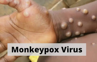 Mokeypox virus