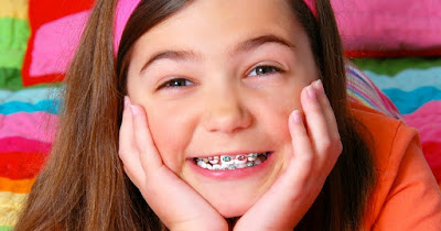  Niềng răng trẻ em có hạn chế gì?