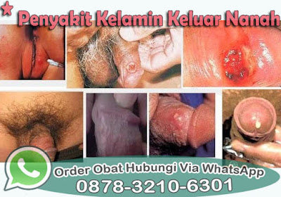 Obat Cina Untuk Sakit Kencing