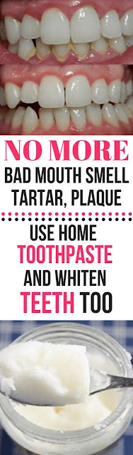 No More Bad Mouth Smell, Tartar, Plaque Using This Best Home Teeth Whitening Toothpaste
