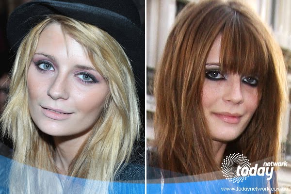 Mischa Barton Plastic Surgery