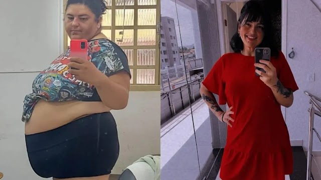 Mulher que pesava 171 kg muda hábitos, emagrece e impressiona ao mostrar antes e depois: ‘Tinha dificuldades até para conversar’