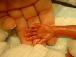 Xavier's Hand