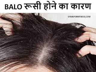 Balo me Rusi Hone Ke Karan l hair dandruff l Rusi ke 30+ prakrtik Upay by gyanpointweb