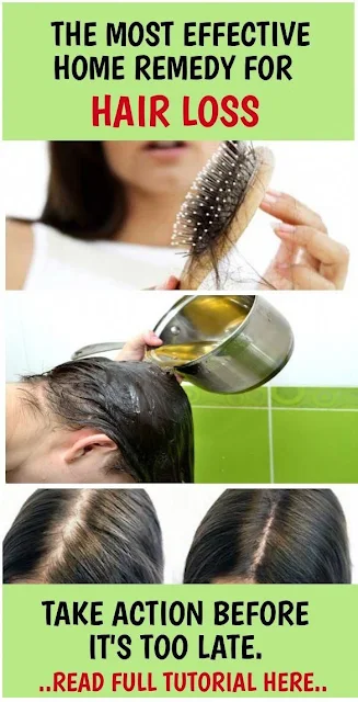 All Natural Hair Loss Remedies