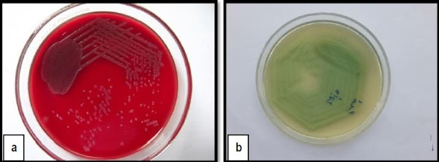 Growth of Pseudomonas aeruginosa on culture media.