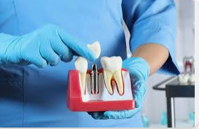 The Benefits Of Dental Insurance