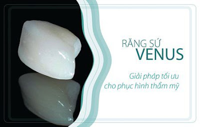 Chi phí răng sứ venus 