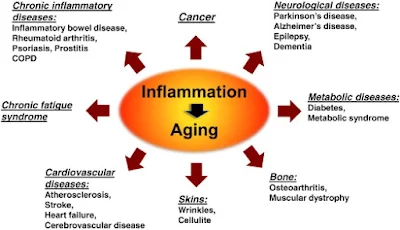 Inflammation and Aging