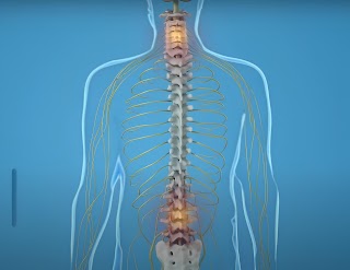 What are Osteophytes Disease Symptoms and Treatment?