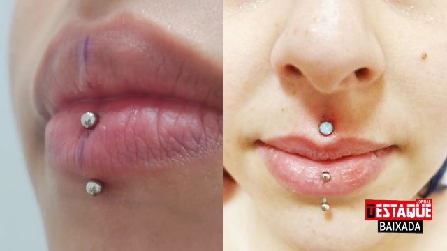 Piercing na boca: veja quais os cuidados para a saúde bucal