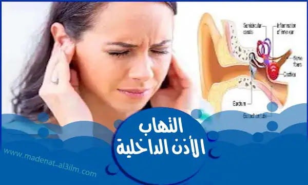 التهاب الأذن الداخلية