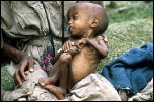The hungry children in Africa
