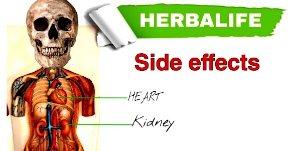 Herbalife Products Side Effects: The Hidden Dangers of Herbalife Products