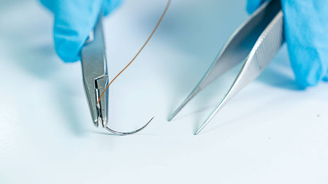 Surgical Sutures Market