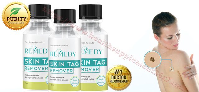 Remedy Skin Tag Remover