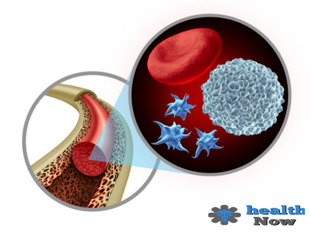 Symptoms of bone marrow malignant growth