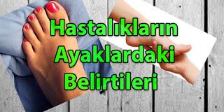 ayak hastalıkları