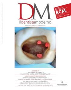 DM Il Dentista Moderno - Febbraio 2013 | ISSN 1827-3726 | TRUE PDF | Mensile | Professionisti | Medicina | Odontoiatria | Implantologia
Da oltre trent’anni DM Il Dentista Moderno rappresenta il punto di riferimento per l’informazione tecnica e specializzata per l’odontoiatra; la sua tiratura certificata ne assicura una diffusione capillare.  La rivista è diretta da un Comitato scientifico di grande esperienza e autorevolezza che garantisce la qualità degli interventi.  DM Il Dentista Moderno viene realizzato, mensilmente, con il contributo di docenti universitari e di liberi professionisti e offre, attraverso una rigorosa selezione di articoli, informazioni teoriche, pratiche e operative particolarmente utili nell’attività clinica. Gli abbonati possono iscriversi a corsi ECM on line e acquisire crediti, rispondendo esattamente alle domande proposte alla fine dello studio.
In ogni numero vengono pubblicati lavori che abbracciano tutte le discipline dell’odontoiatria. All’interno, un aggiornamento monografico, articoli sulle più innovative ricerche scientifiche e casi clinici significativi, abstract, rubriche sugli aspetti pratici legati alla professione; un’inchiesta e un’intervista a un personaggio di spicco danno infine un quadro di quello che succede nel settore.