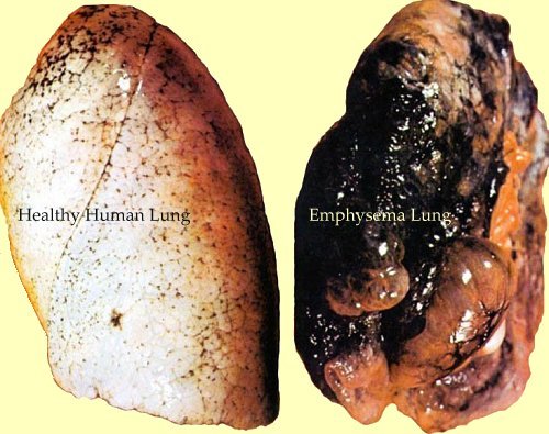 before and after smoking lungs. wallpaper smoking reverse