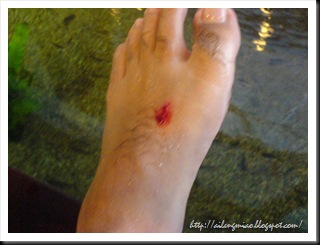 fishspa8