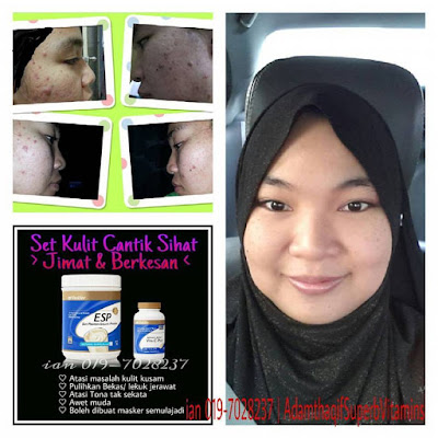 pengedar shaklee johor, pengedar shaklee johor bahru, pengedar shaklee ulu tiram, pengedar shaklee kota tinggi