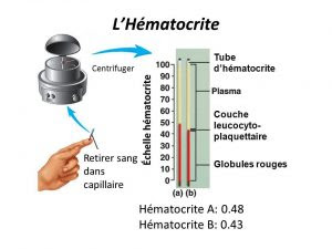 pemeriksaan hematokrit,pemeriksaan hematokrit adalah,pemeriksaan hematokrit pdf,pemeriksaan hematokrit metode mikrohematokrit pdf,pemeriksaan hematokrit metode mikrohematokrit,pemeriksaan hematokrit metode makro,pemeriksaan hematokrit metode mikro,pemeriksaan hematokrit mikro,pemeriksaan hematokrit metode makro dan mikro,pemeriksaan hematokrit metode wintrobe,pemeriksaan hematokrit pada pasien dbd,pemeriksaan hematokrit untuk,pemeriksaan hematokrit ppt,pemeriksaan hematokrit pada ibu hamil,pemeriksaan hematokrit jurnal,pemeriksaan hematokrit darah,pemeriksaan hematokrit metode makro pdf,journal pemeriksaan hematokrit,laporan pemeriksaan hematokrit,tujuan pemeriksaan hematokrit,jurnal pemeriksaan hematokrit pdf,alat pemeriksaan hematokrit,arti pemeriksaan hematokrit