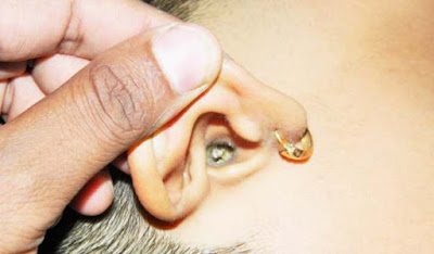 ear wax kotoran telinga serumen