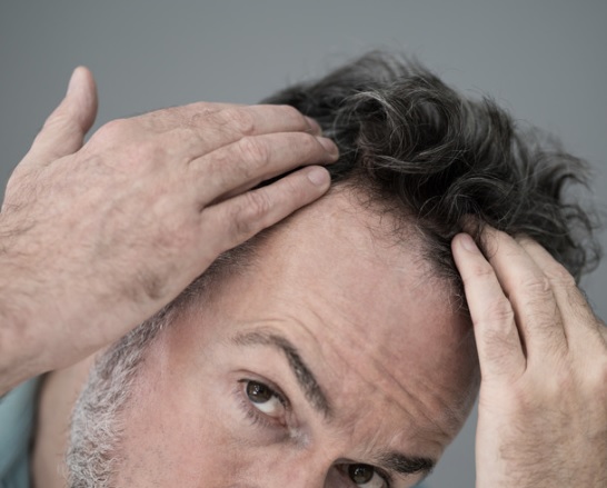 best ways to stop hair loss