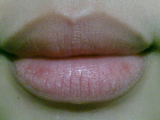 Lips Before - NIVEA Essential Care Lip Balm