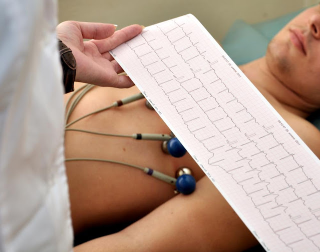 berapa biaya rekam jantung dengan EKG