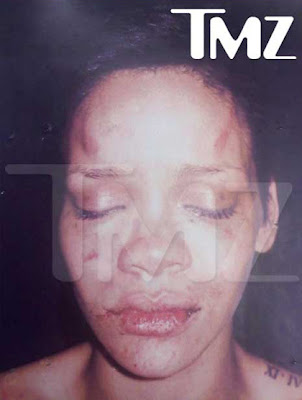 rihanna chris brown fight pics. Chris Brown Rihanna