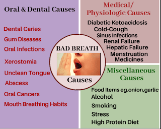 Causes of bad breath,halitosis causes,muh ji badboo ke karn