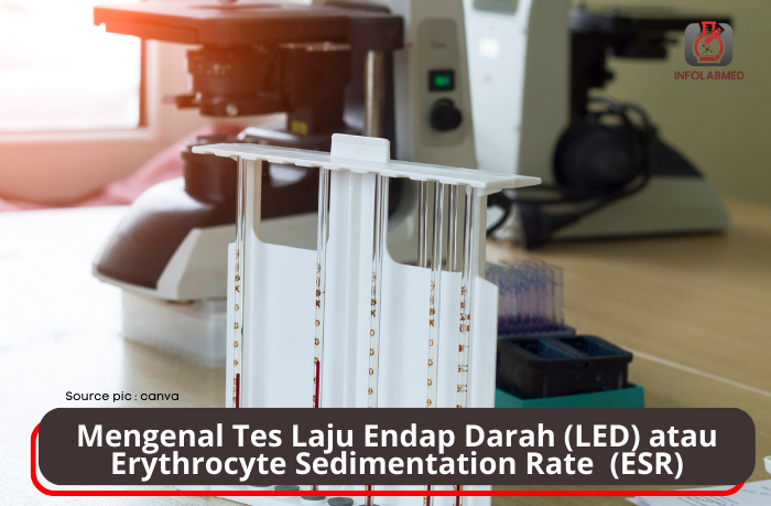 Mengenal Tes Laju Endap Darah (LED) atau Erythrocyte Sedimentation Rate  (ESR)