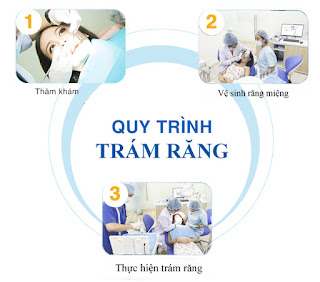 Cách hàn răng sâu như thế nào là đảm bảo?