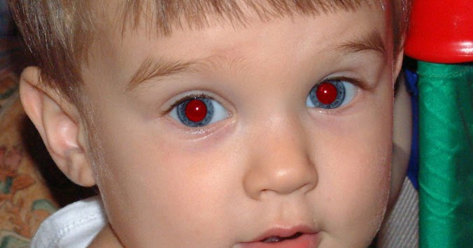 Download BioLOG: The Red Eye Effect