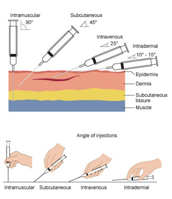 macam macam injeksi dan sudutnya