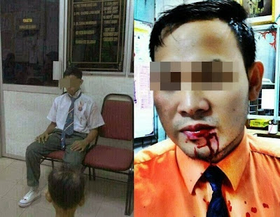 KERENGGA Gambar Guru Pecah Mulut Kena Belasah Dengan Murid