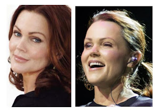 Belinda Carlisle Plastic Surgery