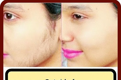 Ladies Read This To Learn How To Get Rid Of Facial Hair Naturally At Home!