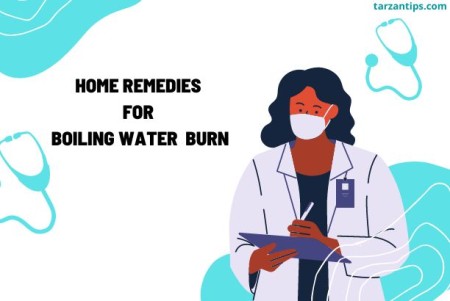 home remedies for boiling water burn