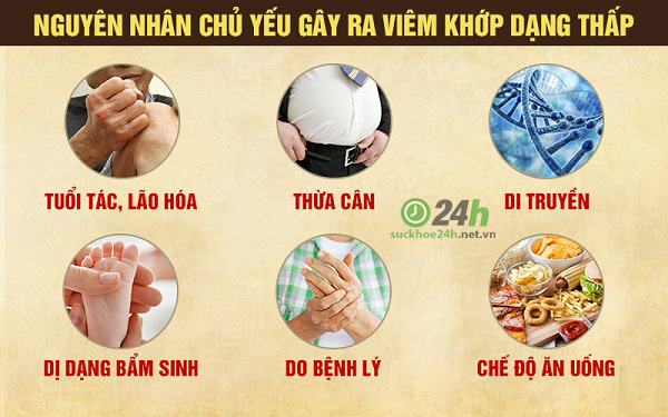 Nguyên nhân gây đau xương nhức khớp