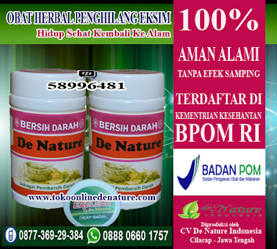 OBAT HERBAL PENGHILANG EKSIM