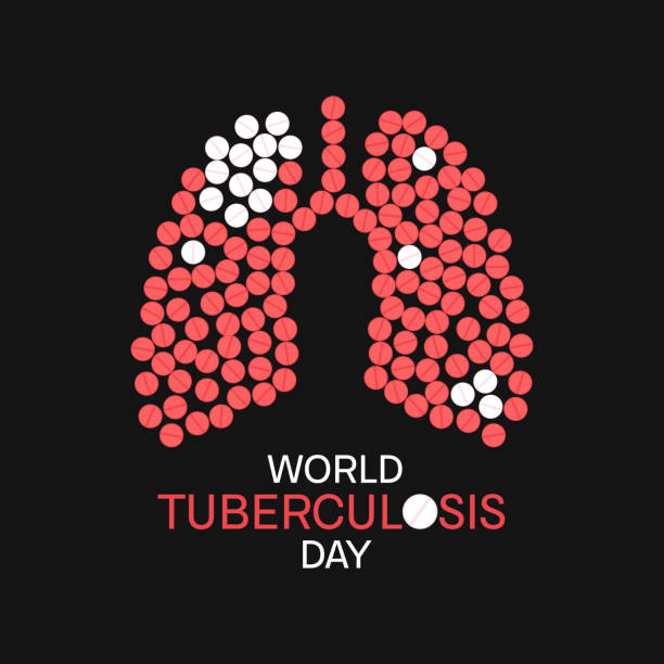 Tuberculosis, conceptual illustration