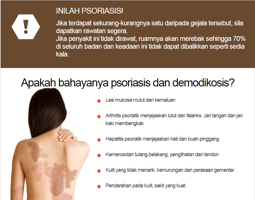 Rawat Sakit Kulit Psoriasis dan Sakit Kulit Lain Dengan 