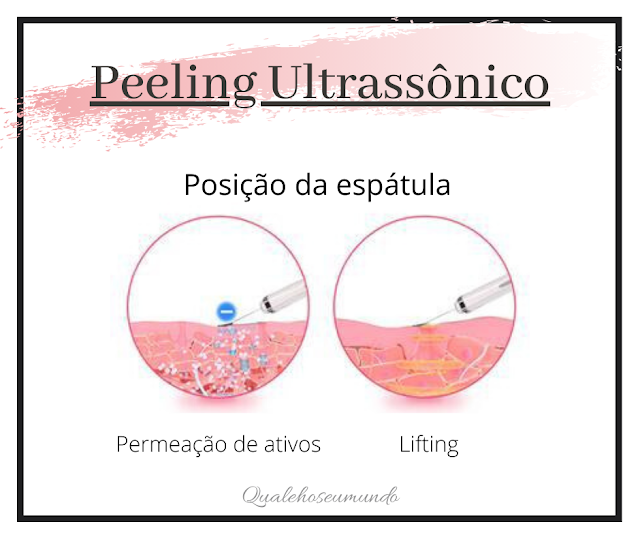 tratar flacidez da pele com peeling