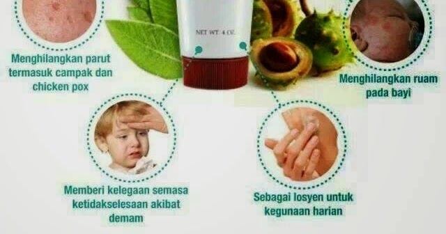 Tips hilangkan RUAM BAYI, PARUT CHICKEN POX, KULIT GATAL 