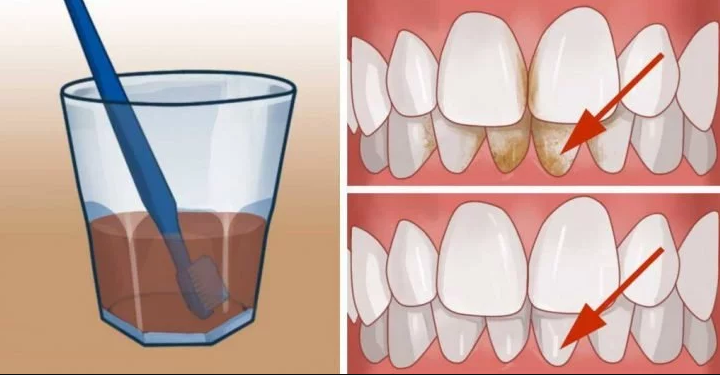 Get Rid Of The Plaque And Whiten Your Teeth At Home