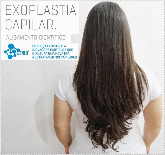 EXOPLASTIA (24) blog EXOPLASTIA (24) blog
