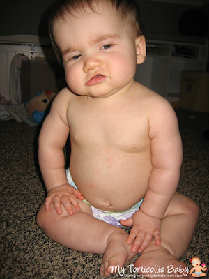 Baby with right torticollis sitting on the floor.